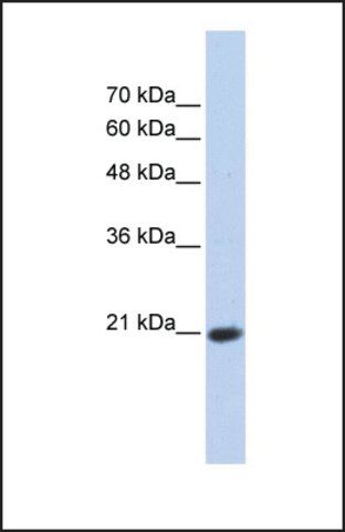 Anti-TCEAL8 antibody produced in rabbit