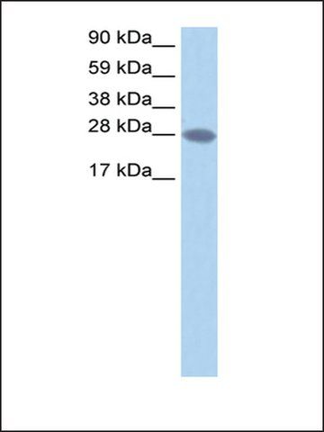 Anti-TCEA2 antibody produced in rabbit