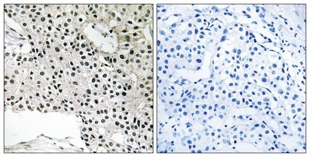 Anti-TCEAL4 antibody produced in rabbit