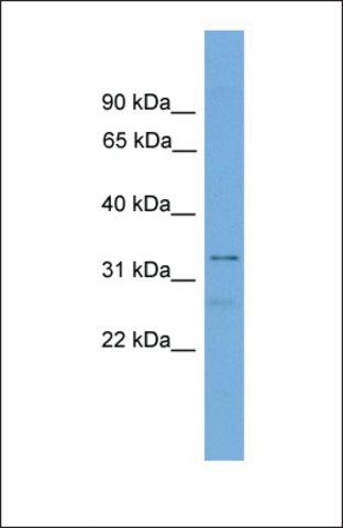 Anti-TCEA2 antibody produced in rabbit