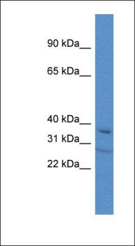 Anti-TCEA3 antibody produced in rabbit