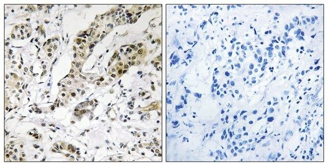 Anti-TCEAL3/5/6 antibody produced in rabbit