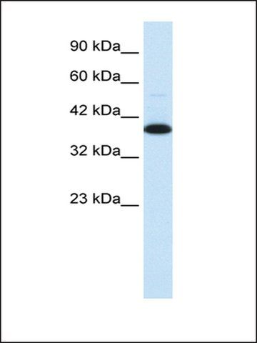 Anti-TCEA3 (AB2) antibody produced in rabbit
