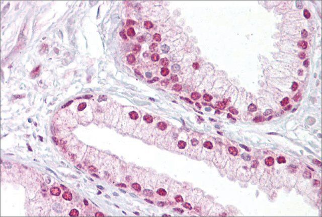 Anti-TCEA1 antibody produced in rabbit