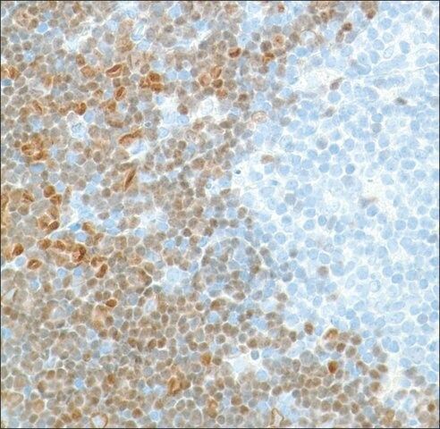 Anti-TDT antibody, Rabbit monoclonal