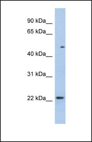Anti-TCEAL3, (N-terminal) antibody produced in rabbit