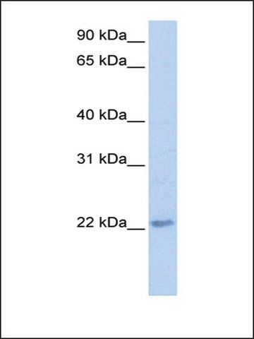 Anti-TCEAL2 antibody produced in rabbit