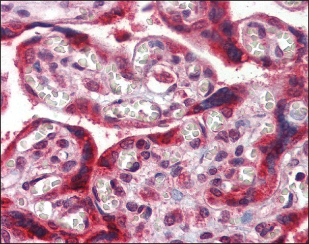 Anti-TMC8 / EVER2 antibody produced in rabbit