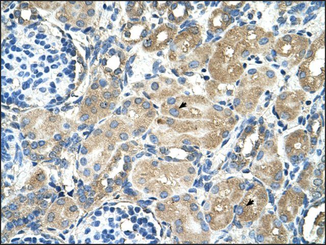 Anti-TM9SF1 (AB2) antibody produced in rabbit