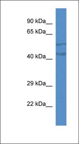 Anti-TMEM102 antibody produced in rabbit