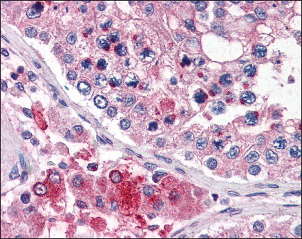 Anti-TMC6 antibody produced in rabbit