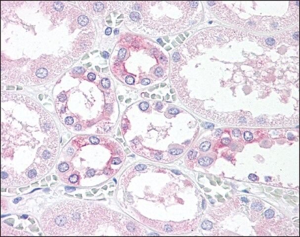 Anti-TM9SF4 antibody produced in rabbit