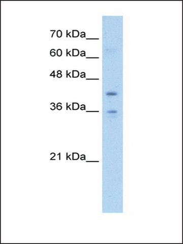 Anti-TMEM104 antibody produced in rabbit