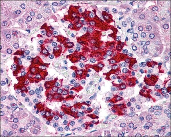 Anti-TM9SF4 antibody produced in rabbit