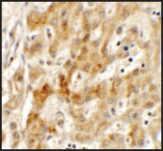 Anti-TMEM106B antibody produced in rabbit
