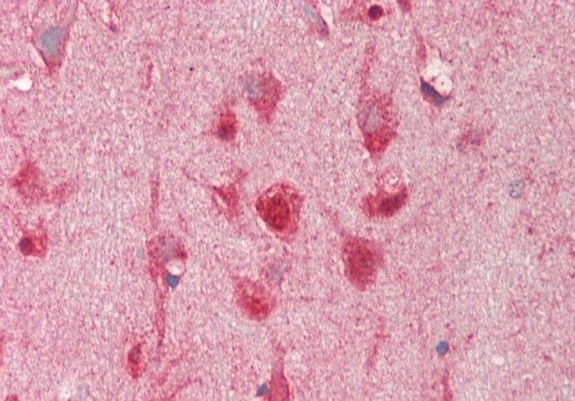 Anti-TMEM16K antibody produced in rabbit