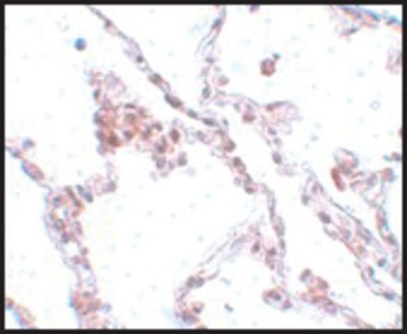 Anti-TMEM184B antibody produced in rabbit