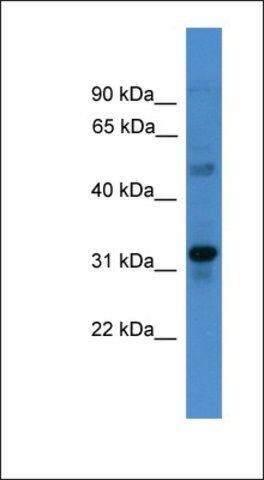 Anti-TMEM176B antibody produced in rabbit