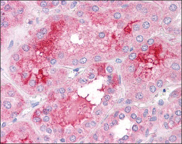 Anti-TMEM184B / C22ORF5 antibody produced in rabbit