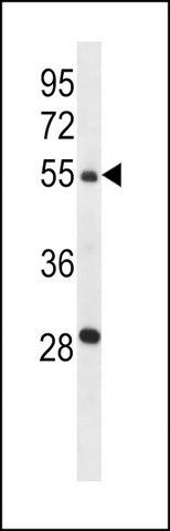 ANTI-TMPRSS13 (C-TERM) antibody produced in rabbit