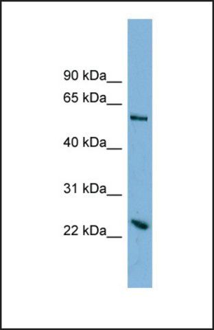 Anti-TMEM161A antibody produced in rabbit