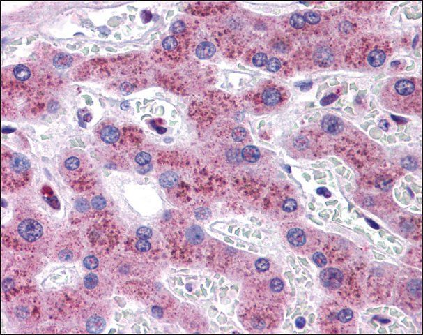 Anti-TMEM18 antibody produced in rabbit