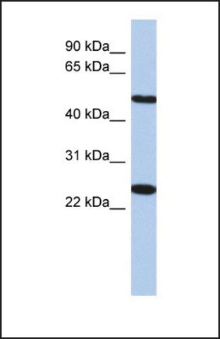 Anti-TMEM161B, (N-terminal) antibody produced in rabbit