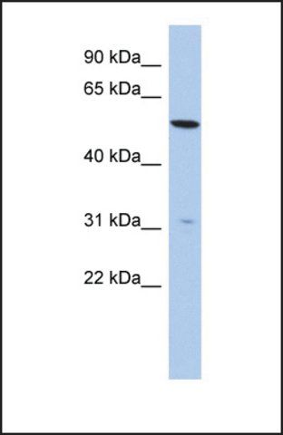 Anti-TMEM161B, (N-terminal) antibody produced in rabbit