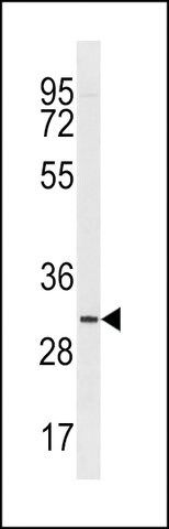 ANTI-TMIGD2 (CENTER) antibody produced in rabbit