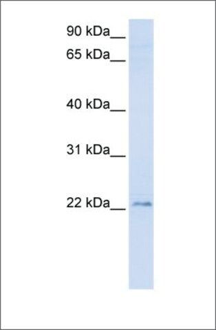 Anti-TMEM9 antibody produced in rabbit