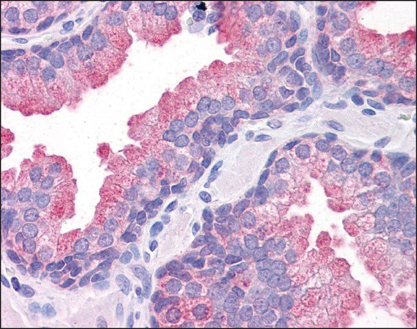 Anti-TMEM184A antibody produced in rabbit