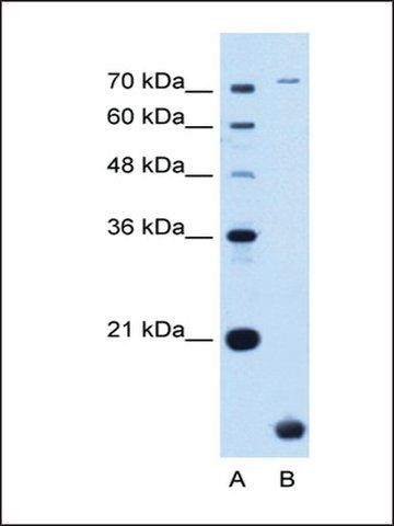 Anti-TMEM91 (AB1) antibody produced in rabbit