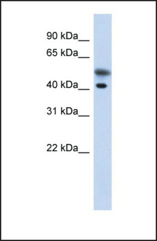 Anti-TMOD2, (N-terminal) antibody produced in rabbit