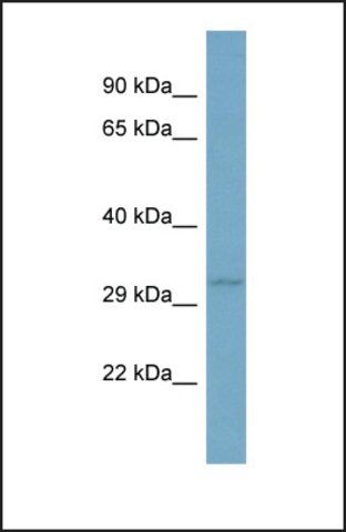 Anti-TNFSF13B, (N-terminal) antibody produced in rabbit
