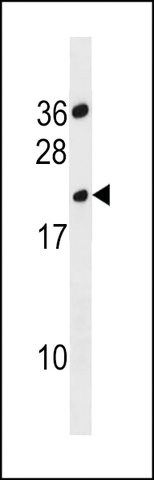 ANTI-TMPRSS11BNL (CENTER) antibody produced in rabbit