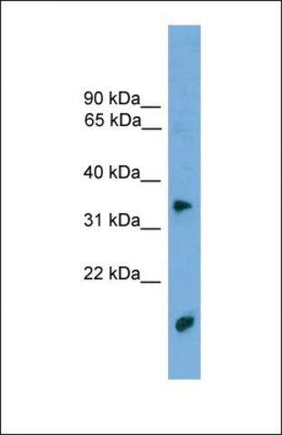 Anti-TMPRSS3, (N-terminal) antibody produced in rabbit