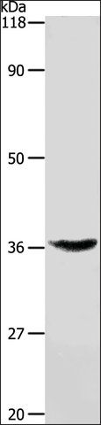 Anti-TNFRSF6 antibody produced in rabbit