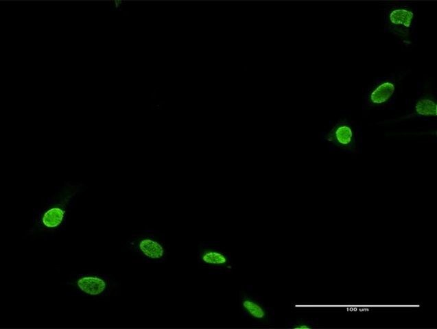 Anti-TNNI3K antibody produced in rabbit