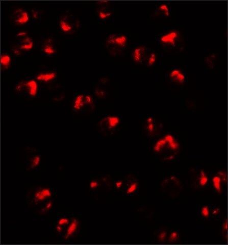 Anti-TNFAIP2 antibody produced in rabbit