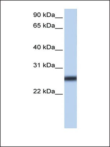 Anti-TMPRSS5 antibody produced in rabbit