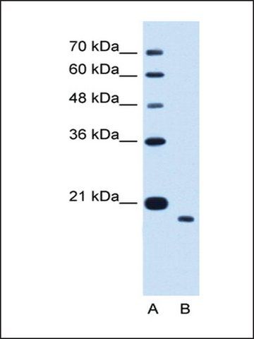 Anti-TMEM91 (AB2) antibody produced in rabbit