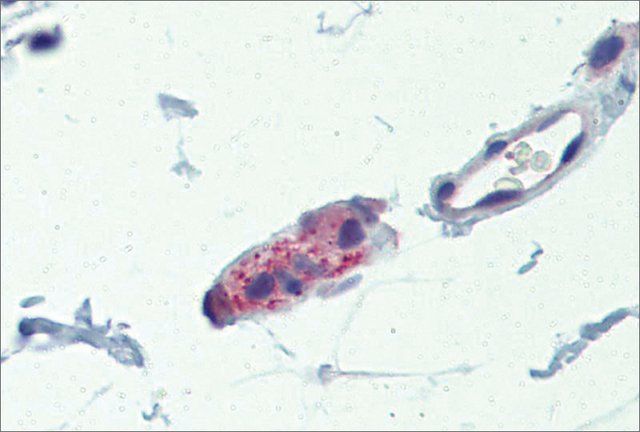 Anti-TNKS (ab1) antibody produced in rabbit