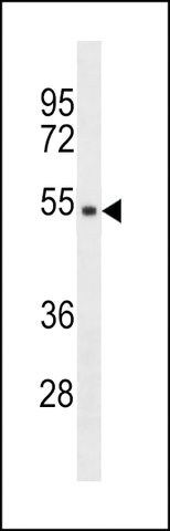 ANTI-TMPPE (CENTER) antibody produced in rabbit