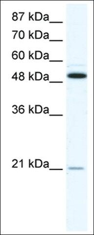 Anti-TNFRSF11B antibody produced in rabbit
