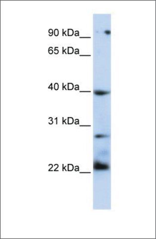 Anti-TNFRSF10B antibody produced in rabbit