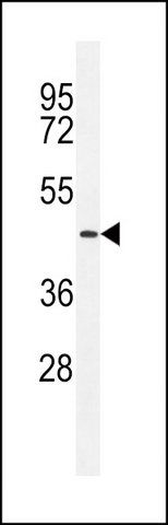 ANTI-TMPRSS11E2 (CENTER) antibody produced in rabbit