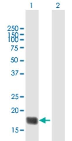 Anti-TMEM86B antibody produced in rabbit