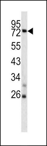 ANTI-TNFAIP2 (CENTER) antibody produced in rabbit
