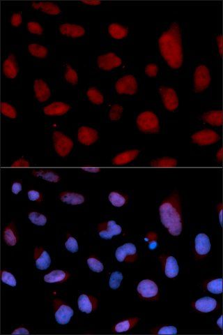 Anti-TNNC1 antibody produced in rabbit