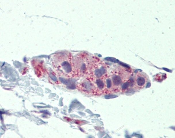 Anti-TNKS (ab2) antibody produced in rabbit